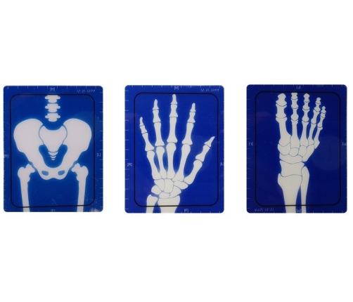 Medical Kit Apparatus Medical Accessories X-ray Doctor